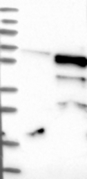 NBP1-87210 - TMPRSS2