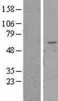 NBL1-17121 - TMPRSS2 Lysate