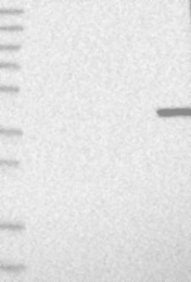 NBP1-85240 - TMPRSS3