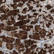 NBP1-82608 - TMPRSS4