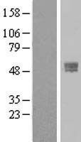 NBL1-17125 - TMPRSS4 Lysate
