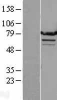 NBL1-17130 - TMTC1 Lysate