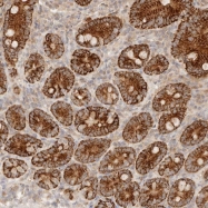 NBP1-84093 - TMTC2
