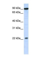 NBP1-59824 - TMTC4