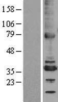 NBL1-17467 - TMX2 Lysate