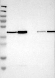 NBP1-85158 - TXNDC13 / TMX4