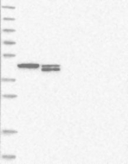 NBP1-85159 - TXNDC13 / TMX4