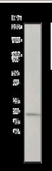 NB110-57620 - Tumor necrosis factor (TNF-alpha)