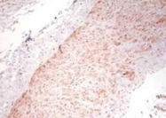 NB600-587 - Tumor necrosis factor (TNF-alpha)