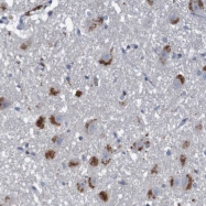 NBP1-87725 - TNF-beta / Lymphotoxin-alpha