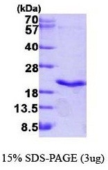 NBP1-41147 - TNF-beta / Lymphotoxin-alpha