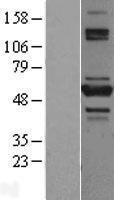 NBL1-17173 - TNIP2 Lysate