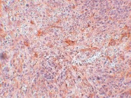 NBP1-77365 - TNIP3