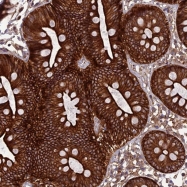 NBP1-89305 - TNIP3