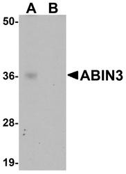 NBP1-77365 - TNIP3