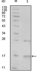 NBP1-47379 - TNK1