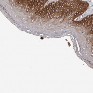 NBP1-91048 - Tenascin-N (TNN)