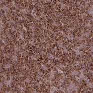NBP1-81585 - Transportin-3 (TNPO3)