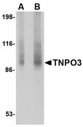 NBP1-76374 - Transportin-3 (TNPO3)