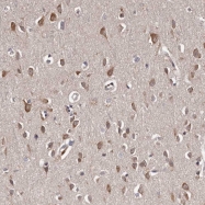 NBP1-89933 - TNRC4 / BRUNOL1