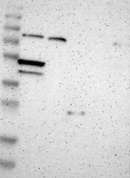 NBP1-89933 - TNRC4 / BRUNOL1