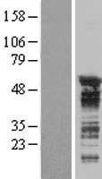 NBL1-17183 - TNRC4 Lysate