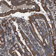 NBP1-91153 - TNRC5 / CNPY3