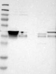 NBP1-91153 - TNRC5 / CNPY3