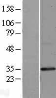 NBL1-09324 - TNRC5 Lysate