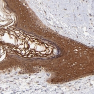 NBP1-81442 - TNRC6B