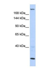 NBP1-57549 - TNRC6B