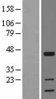 NBL1-17185 - TOB1 Lysate