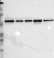 NBP1-86170 - TOM1