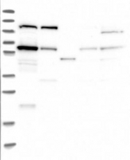 NBP1-86006 - TOM1L2