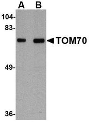 NBP1-77342 - TOMM70A