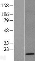 NBL1-17190 - TOMM22 Lysate