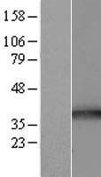 NBL1-17191 - TOMM34 Lysate