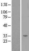 NBL1-17192 - TOMM40L Lysate