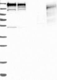 NBP1-89527 - TOP2B