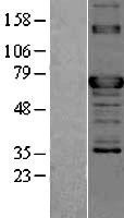 NBL1-17197 - TOR1AIP2 Lysate