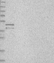 NBP1-89237 - Torsin-3A (TOR3A)