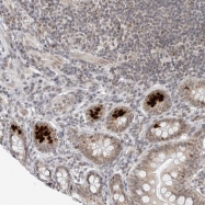 NBP1-88432 - TOX4