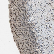 NBP1-88433 - TOX4