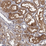 NBP1-83642 - TPCN1