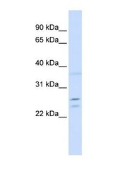 NBP1-56457 - TPD52