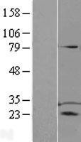 NBL1-17212 - TPD52 Lysate