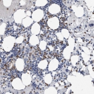 NBP1-84314 - Tumor protein D53 (TPD52L1)