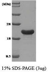 NBC1-18500 - Tumor protein D53 (TPD52L1)