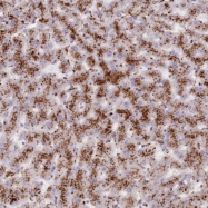 NBP1-85561 - Tripeptidyl-peptidase 1 (TPP1)
