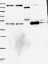 NBP1-85561 - Tripeptidyl-peptidase 1 (TPP1)